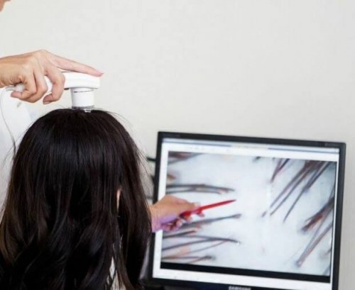 Konsultacja trychologiczna plus badanie trychologiczne